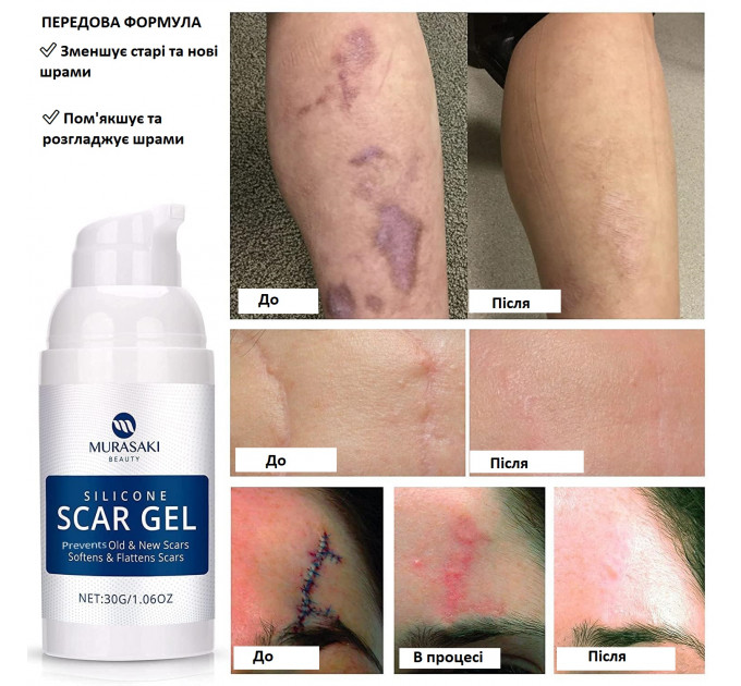 Силиконовый гель против рубцов и растяжек MURASAKI BEAUTY 100% Silicone Scar Gel 30 г