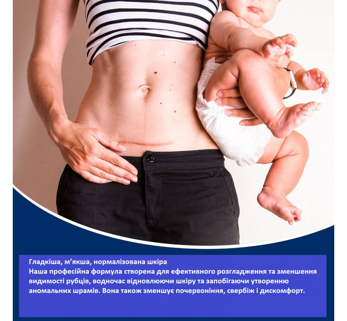 Силиконовый гель против рубцов и растяжек MURASAKI BEAUTY 100% Silicone Scar Gel 30 г