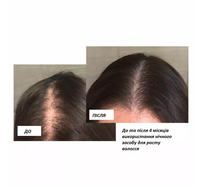 Набір для росту волосся Virtue Flourish з міноксидилом 5% (шампунь кондиціонер піна) для жінок