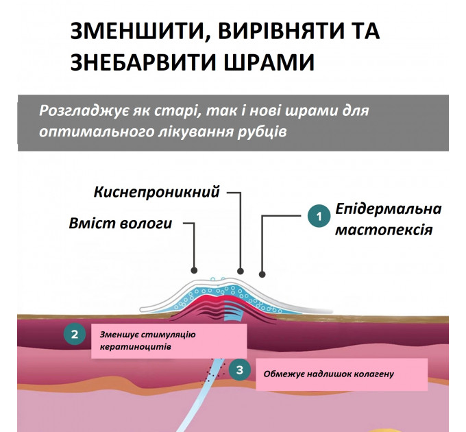 Силіконовий післяопераційний пластир для грудей Biodermis Epi-Derm Mastopexy прозорий 1 пара Made in USA