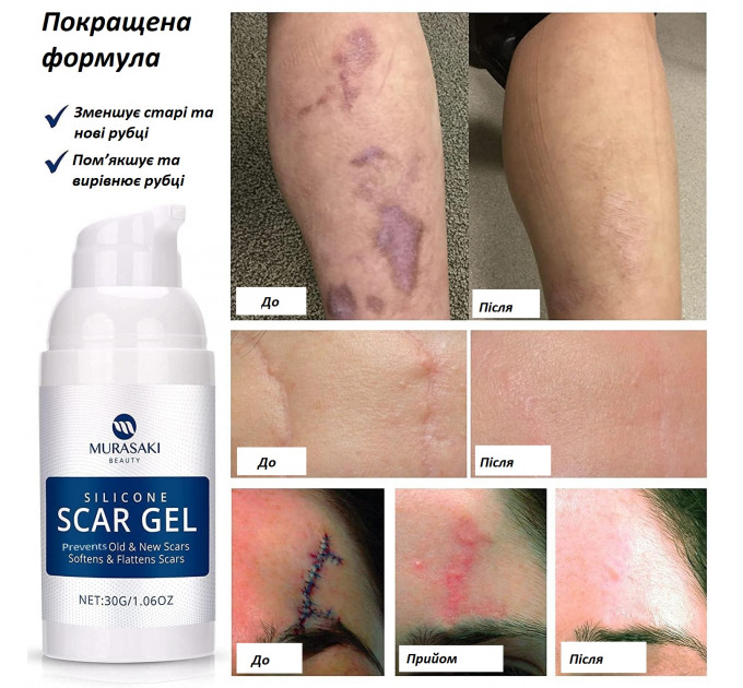 Набір засобів для лікування рубців MURASAKI BEAUTY 100% Silicone Gel 30 г і SPF 30 Cream 30 г