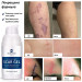 Набір засобів для лікування рубців MURASAKI BEAUTY 100% Silicone Gel 30 г і SPF 30 Cream 30 г