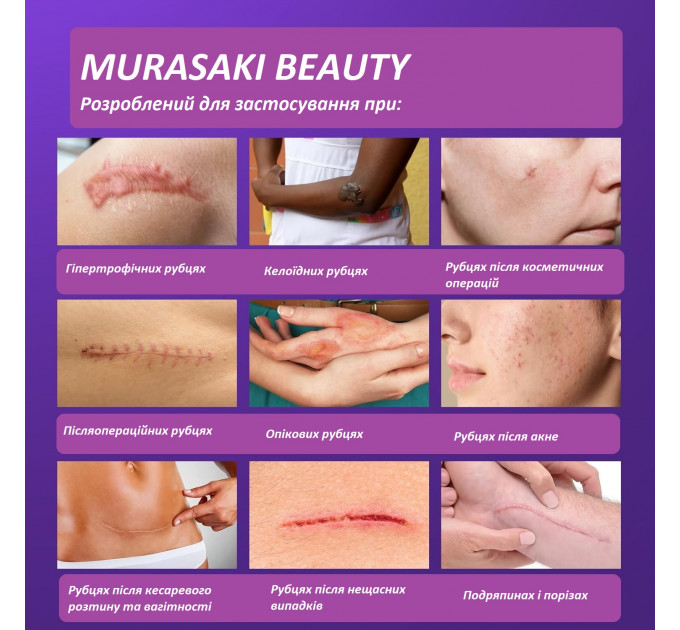 Набір засобів для лікування рубців MURASAKI BEAUTY 100% Silicone Gel 30 г і SPF 30 Cream 30 г