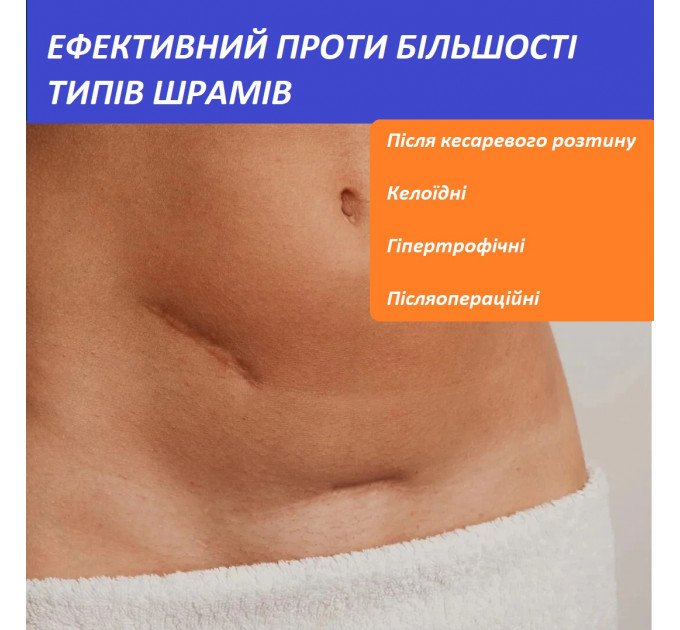 Набір для корекції шрамів Nuvadermis Advanced Scar Treatment (гель 50 мл і патчі 4 шт)