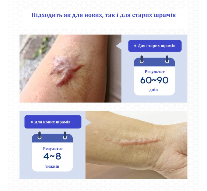 Силіконовий пластир від шрамів Murasaki Beauty 4×150 см