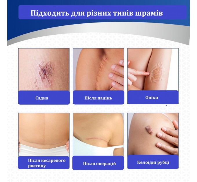 Силіконовий пластир від шрамів Murasaki Beauty 4×150 см