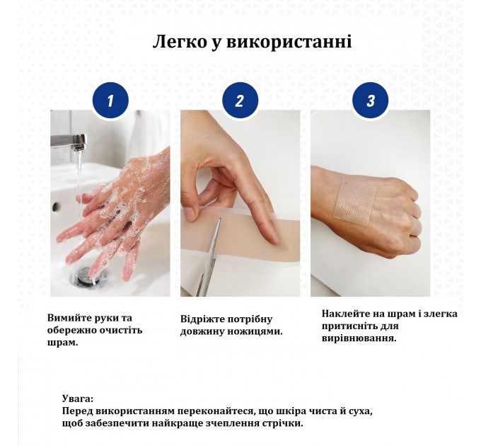 Силіконовий пластир від шрамів Murasaki Beauty 4×150 см