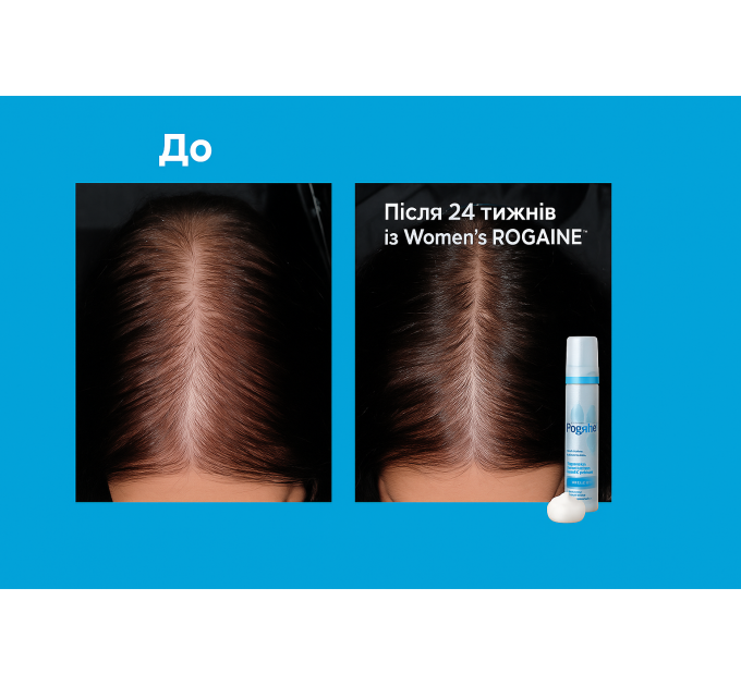 Піна для волосся Women's ROGAINE 5% Minoxidil Unscented Foam 2 флакони