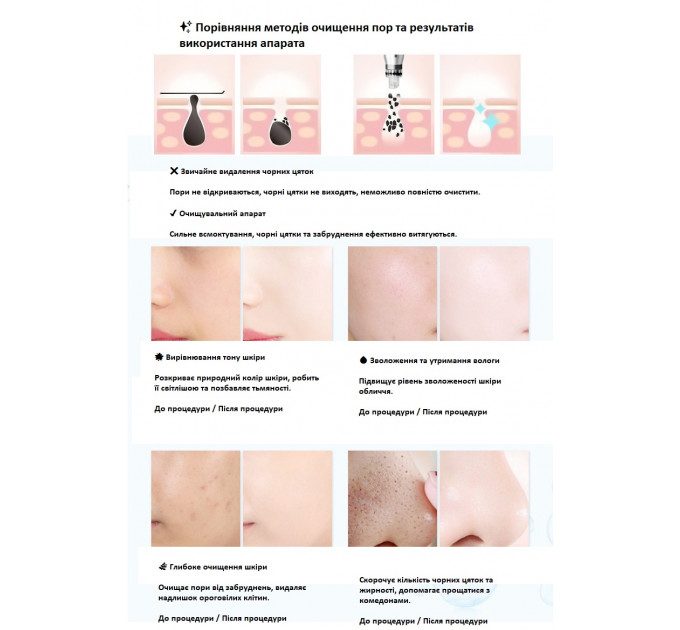 Косметологічний апарат для гідро-кисневого очищення шкіри 2-е покоління 8-в-1