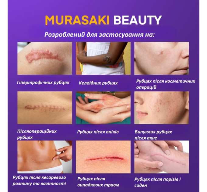 Силіконовий гель від шрамів і рубців з SPF 30 Murasaki Beauty 30 г