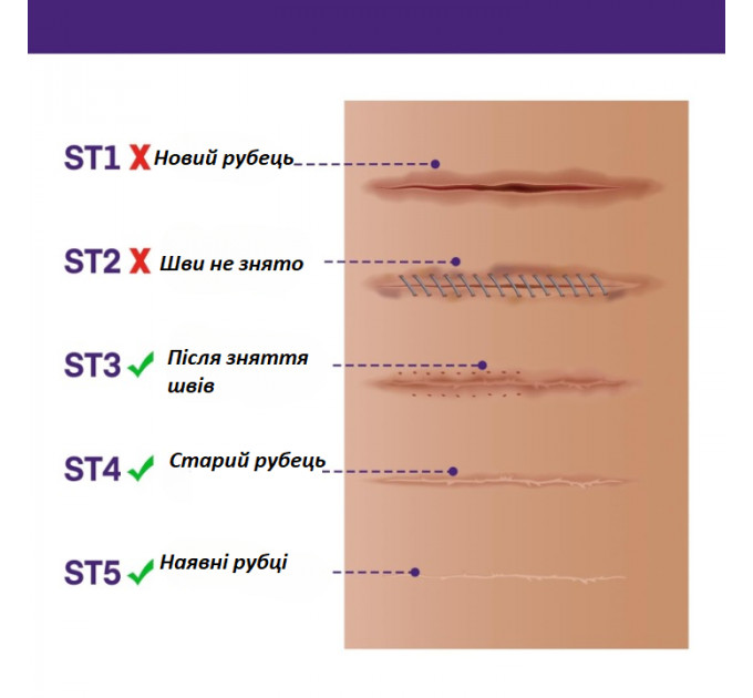 Силіконовий гель від шрамів і рубців з SPF 30 Murasaki Beauty 30 г