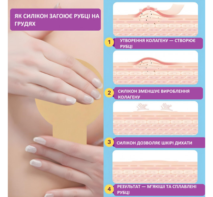 Силиконовые накладки для шрамов на груди Miztag 2 шт