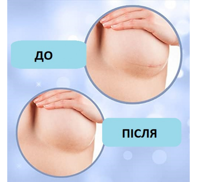 Силиконовые накладки для шрамов на груди Miztag 2 шт