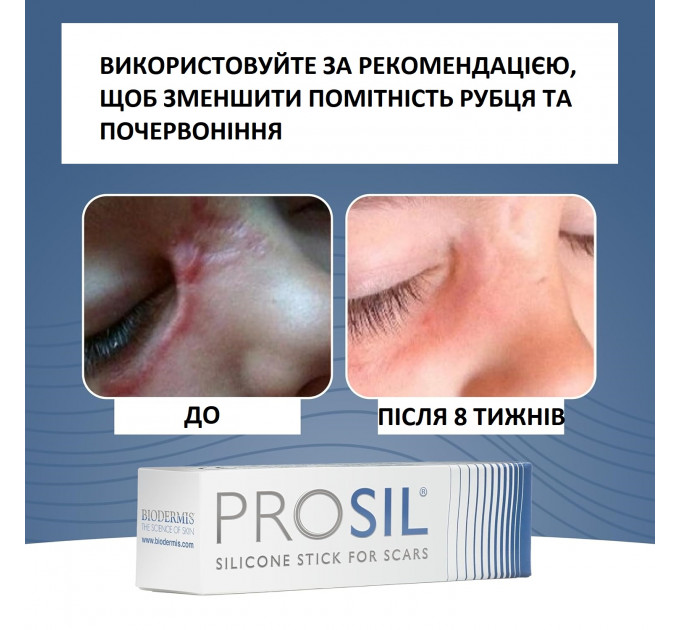 Силіконовий стік для шрамів і рубців PROSIL 4,25 г