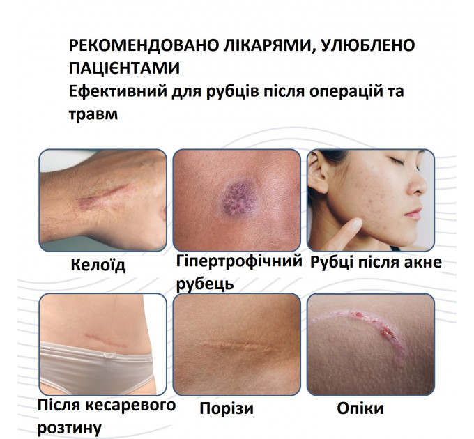 Силіконовий стік для шрамів і рубців PROSIL 4,25 г