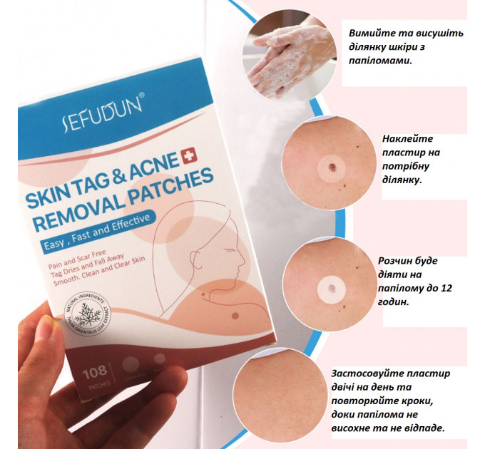 Пластир для точкового видалення бородавок і прищів від акне SEFUDUN 108 шт.