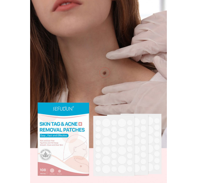 Пластир для точкового видалення бородавок і прищів від акне SEFUDUN 108 шт.