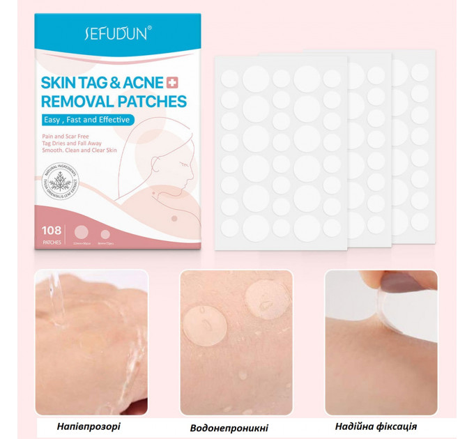 Пластир для точкового видалення бородавок і прищів від акне SEFUDUN 108 шт.