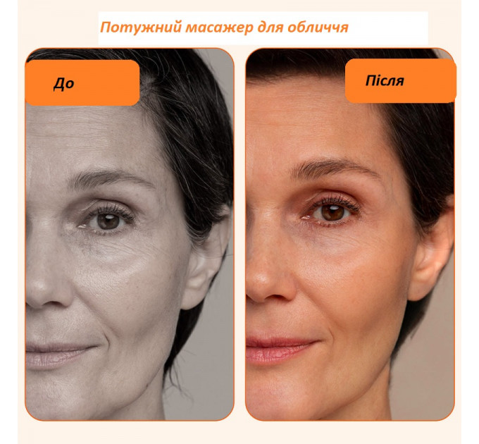 Апарат для радіочастотного ліфтингу та омолодження шкіри обличчя і тіла Dr. Fuchs Tempura Lift RF