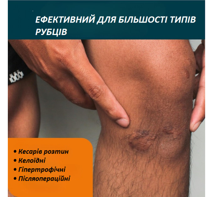 Набір для шрамів і рубців Nuvadermis денний гель AM Scar Gel 50 мл і нічний крем PM Intensive Scar Cream 40 мл