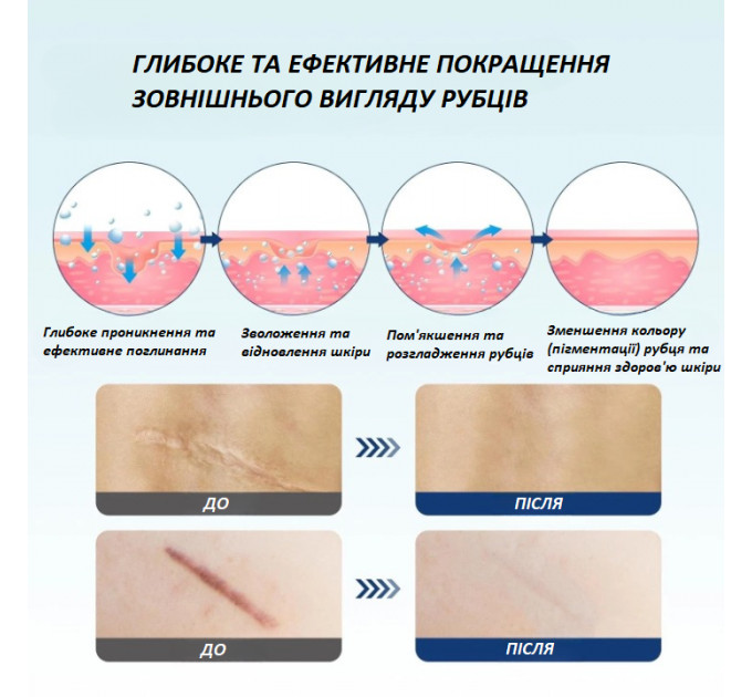 Набір для видалення рубців і шрамів Boysea Advanced Scar Removal Set сироватка 30 мл і крем 30 г