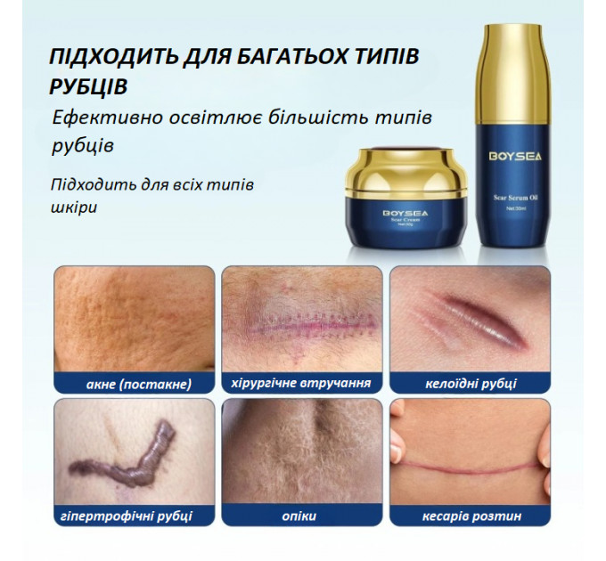 Набір для видалення рубців і шрамів Boysea Advanced Scar Removal Set сироватка 30 мл і крем 30 г