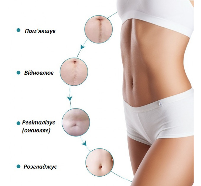 Силіконові пластирі від шрамів і рубців ELAIMEI Silicone Scar Sheets 7.6х4 см 20 шт.