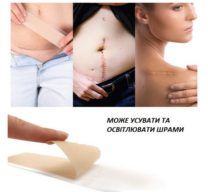 Силіконові пластирі від шрамів і рубців ELAIMEI Silicone Scar Sheets 7.6х4 см 20 шт.