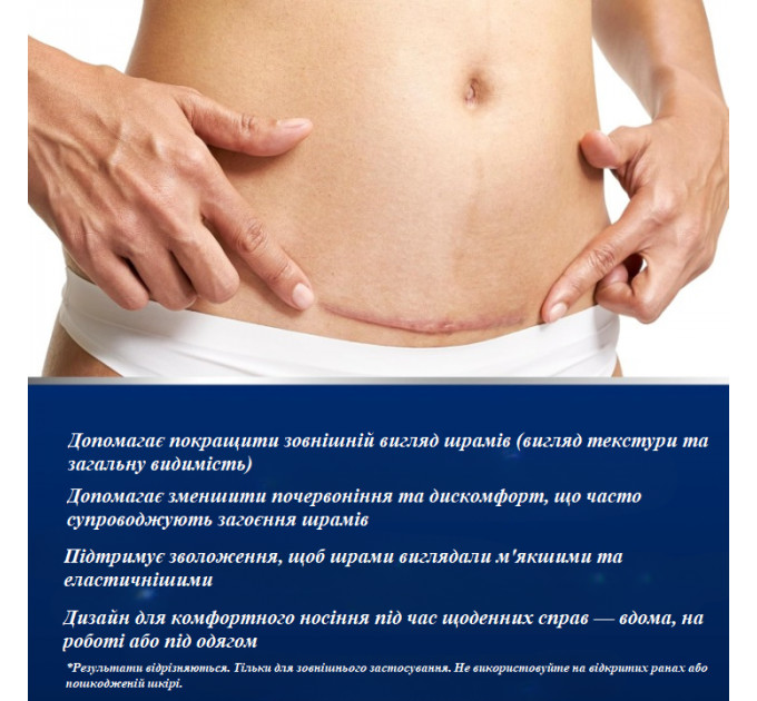 Силіконові пластирі від шрамів і рубців Murasaki Beauty 4 шт розмір 15 x 4 см бежеві