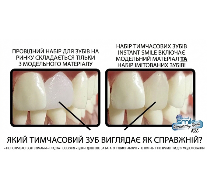 Набір для тимчасової заміни зуба Instant Smile 30 Assorted Temporary Tooth Kit Deluxe (30 шт 3 відтінки)