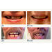 Набір для тимчасової заміни зуба Instant Smile 30 Assorted Temporary Tooth Kit Deluxe (30 шт 3 відтінки)