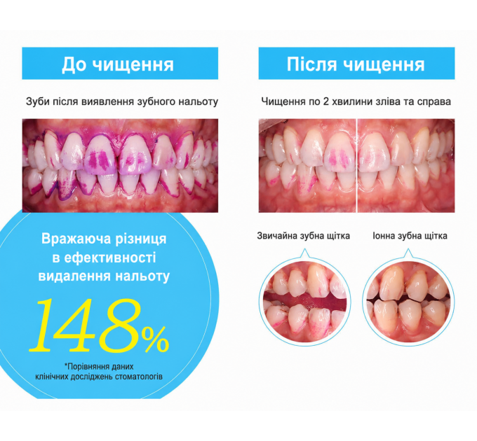 Зубна паста Sangi APAGARD ROYAL нано-відбілювання та ремінералізація емалі 2 шт по 40 г + зубна щітка Kiss You Ionic Toothbrush Made in Japan