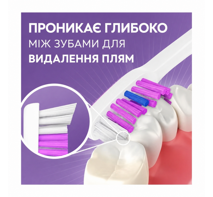Набір для відбілювання зубів паста Crest 3D White Advanced Radiant Mint 68 г і м'яка зубна щітка Oral-B Advanced Whitening