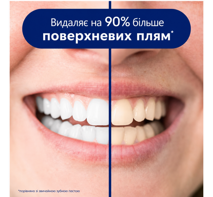 Набір для відбілювання зубів паста Crest 3D White Advanced Radiant Mint 68 г і м'яка зубна щітка Oral-B Advanced Whitening