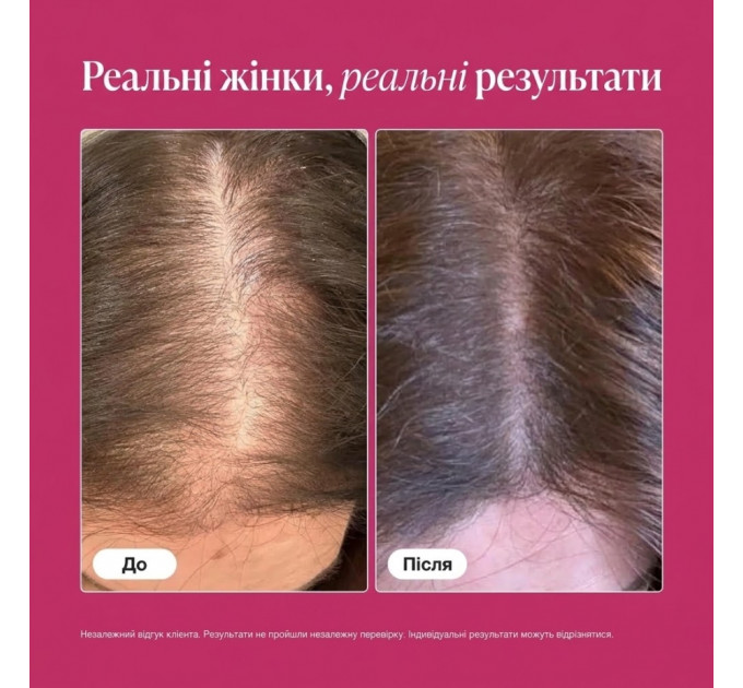 Дієтична добавка для росту волосся Viviscal Pro Advanced Hair Health для чоловіків і жінок 180 таблеток