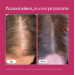 Дієтична добавка для росту волосся Viviscal Pro Advanced Hair Health для чоловіків і жінок 180 таблеток