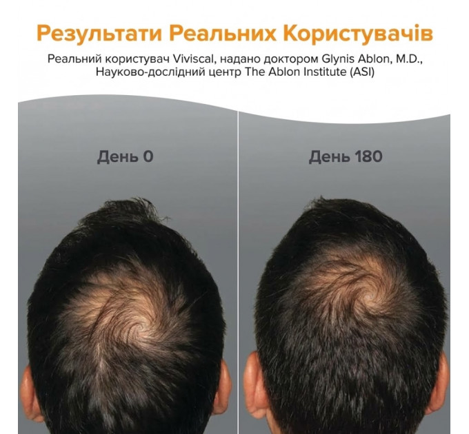 Дієтична добавка для росту волосся Viviscal Pro Advanced Hair Health для чоловіків і жінок 180 таблеток