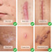 Гель против шрамов и рубцов Cicatricure для лица и тела (28 гр)