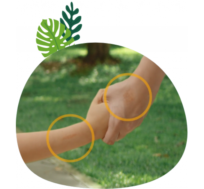 Дитячий гель від шрамів Dermatix Ultra Kids