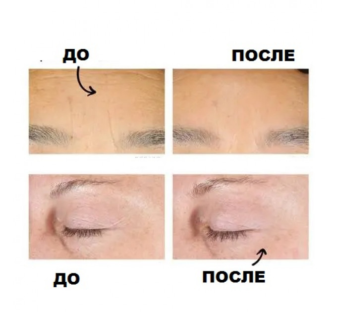 Омолаживающая сыворотка для лица Kiehl's Retinol Skin-Renewing Daily Micro-Dose Serum