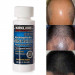 Экстра сильный раствор Kirkland Minoxidil 5% для восстановления роста волос для мужчин