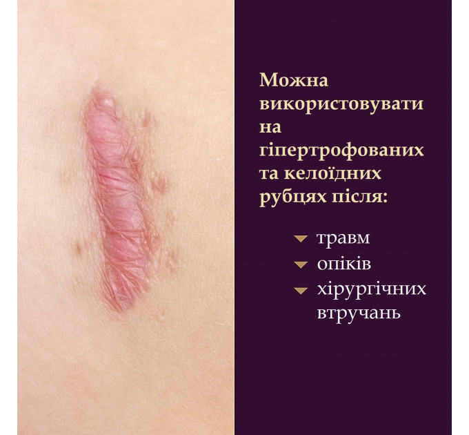 Силіконовий пластир від шрамів та рубців Mederma Silicone Scar Sheet