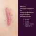 Силіконовий пластир від шрамів та рубців Mederma Silicone Scar Sheet