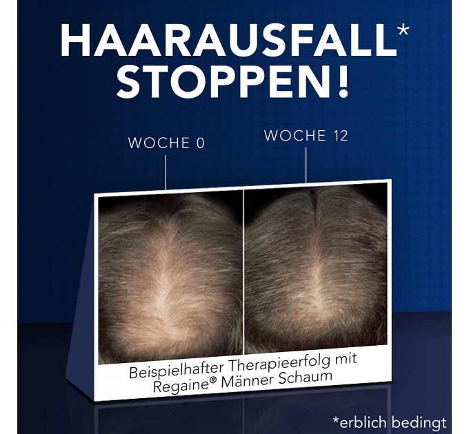 Раствор от выпадения волос у мужчин Regaine Minoxidil 5%