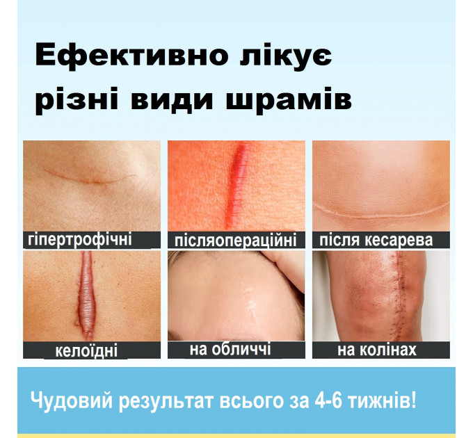 Гель проти рубців і шрамів Scarguard Scar Repair Liquid з вітаміном Е (15 мл)