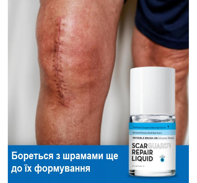 Гель проти рубців і шрамів Scarguard Scar Repair Liquid з вітаміном Е (15 мл)
