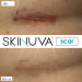 Крем от шрамов с факторами роста Skinuva Next Generation Scar Cream