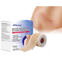 Пластир від шрамів та рубців силіконовий South Moon (150х4 см)