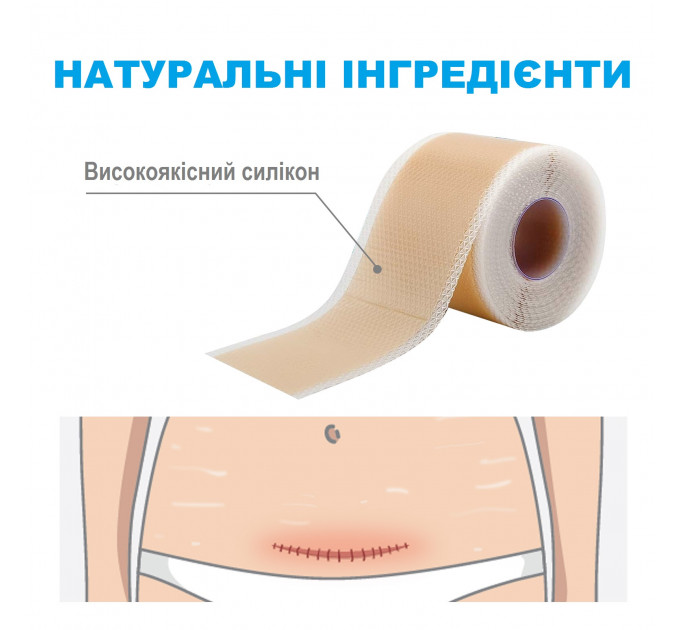 Пластир від шрамів та рубців силіконовий South Moon (150х4 см)