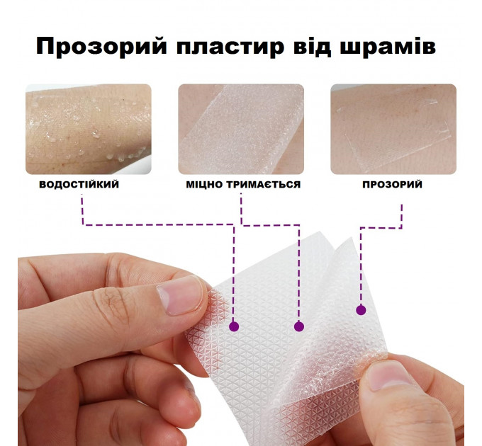 Силіконовий пластир від шрамів та рубців Elaimei Silicone Scar Sheets (4х152 см)
